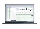 Холтерівський набір Cardiac Navigator™ для малих клінік (локальна база даних)
