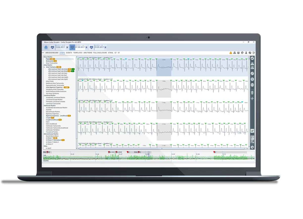 Комплект холтера Cardiac Navigator™ (локальна база даних) базовий