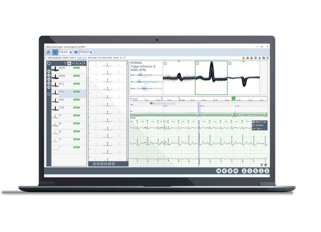 Програмне забезпечення Cardiac Navigator™ Події